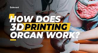 How Is 3D Printing Technology Revolutionizing Healthcare?